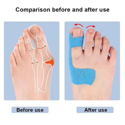 Bunion Relief Toe Alignment Correction Stickers