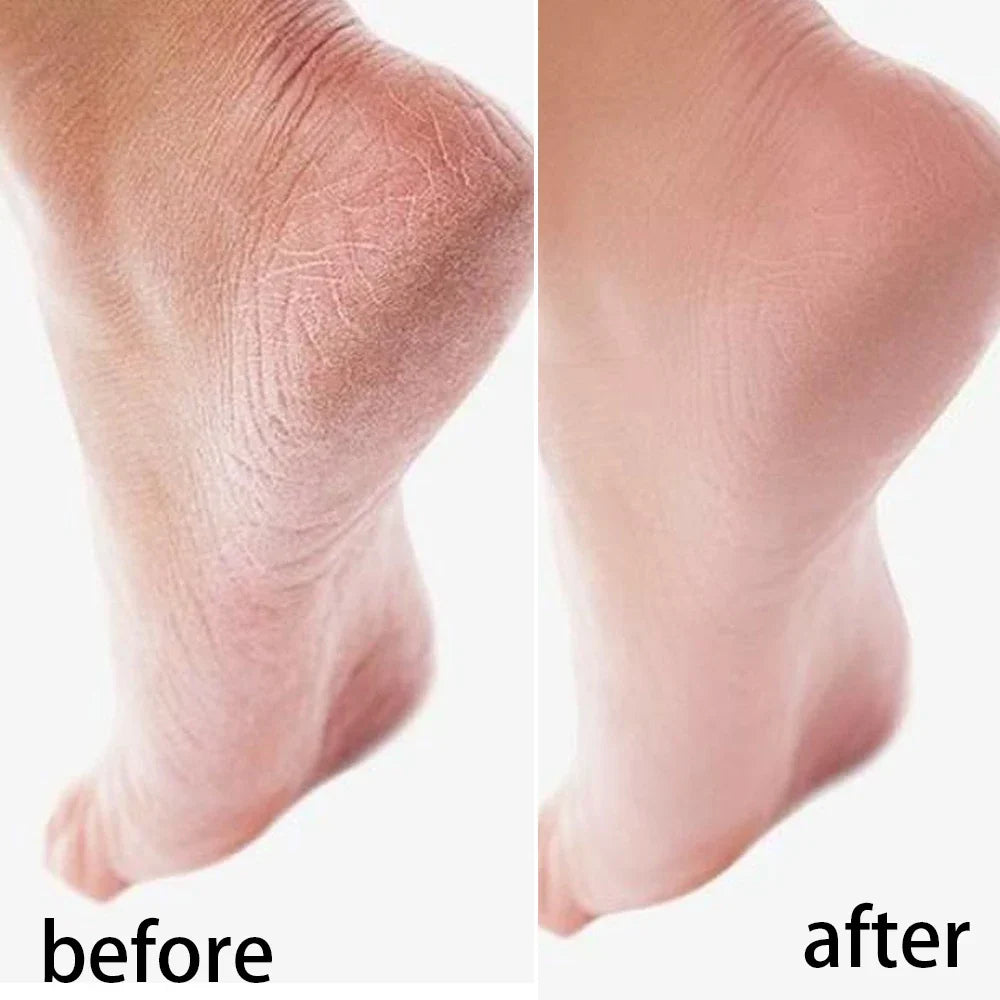 Moisturizing Reusable Hydrating Socks
